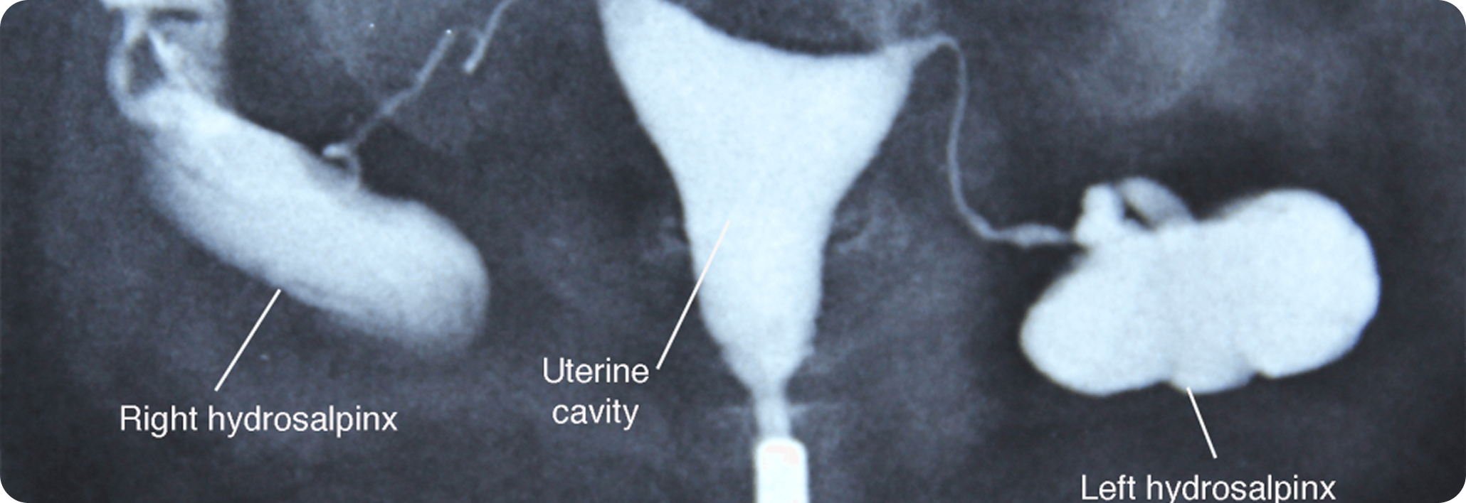 Step 1: Evaluation & imaging