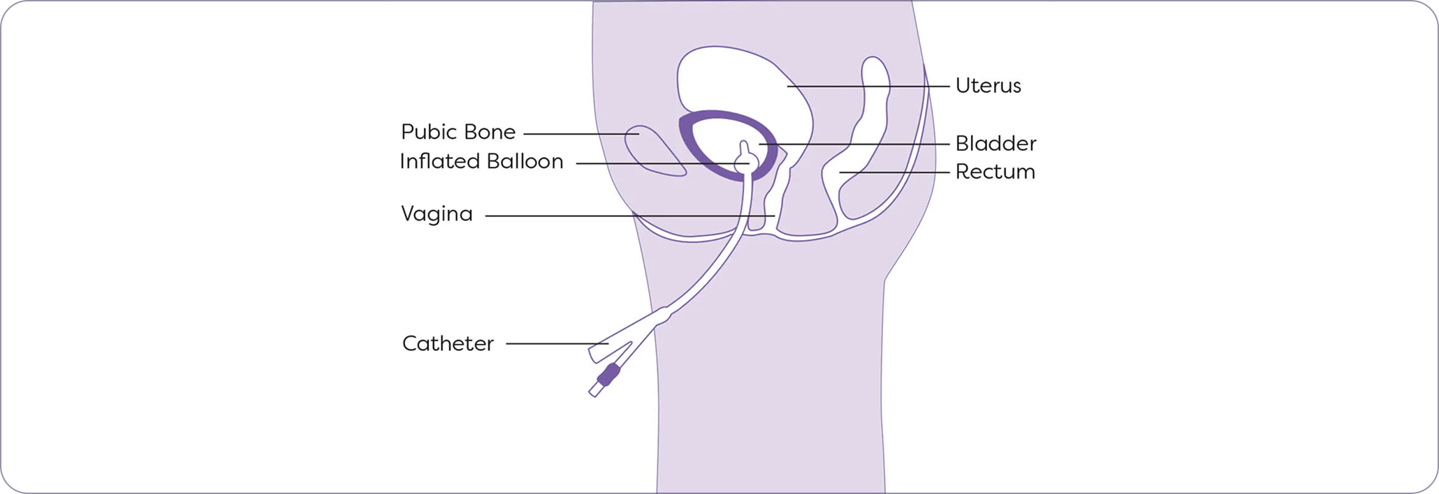 Step 2: Planning & access