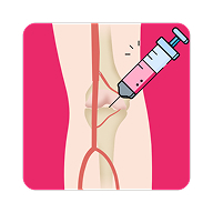 Platelet Rich Plasma