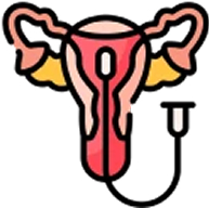 Uterine Artery Embolization icon
