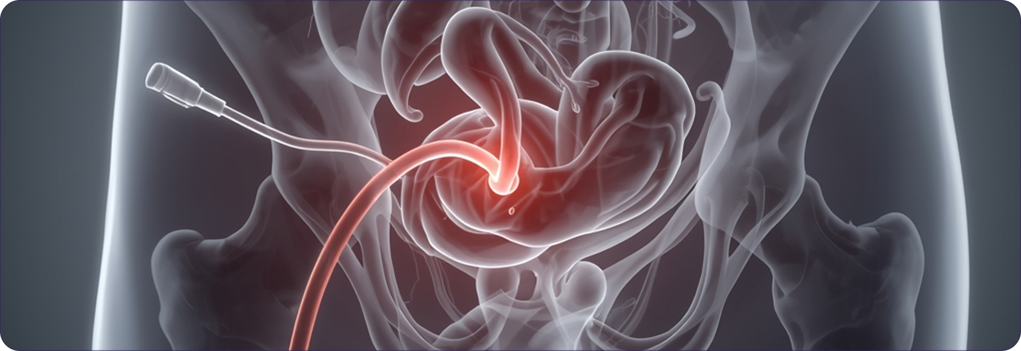 Medical imaging showing veins and a catheter