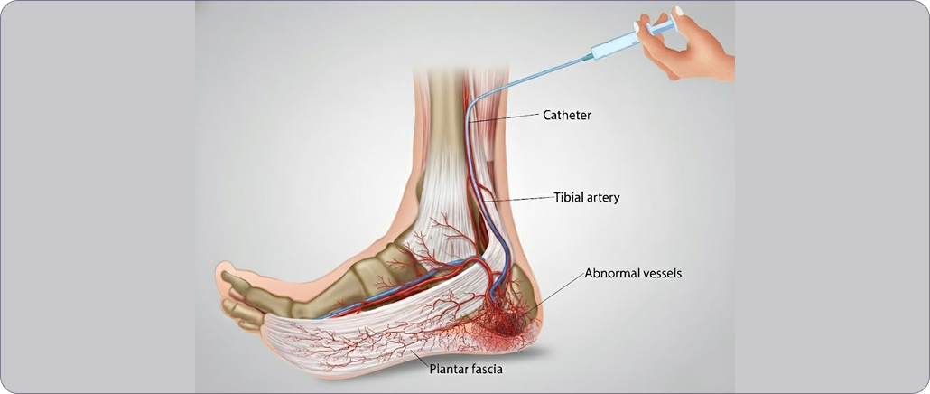 Healing process begins